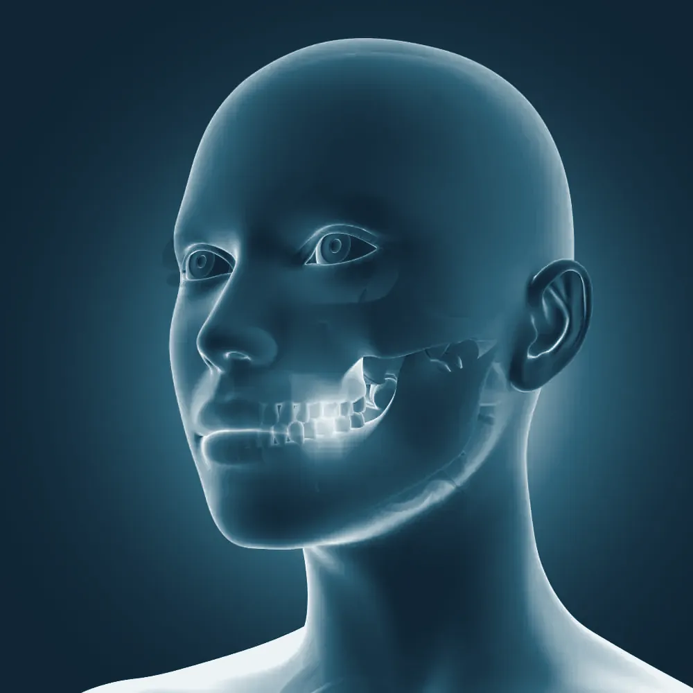 Ilustración de la articulación temporomandibular con la zona de dolor resaltada